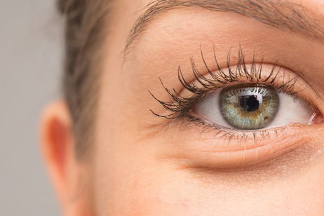 ¿Tienes ojeras? Estas son algunas de las razones según dermatólogos ¿Tienes ojeras? Estas son algunas de las razones según dermatólogos