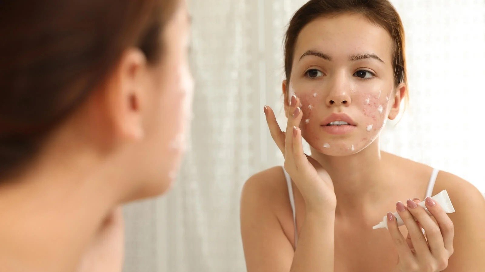 Mujer aplicando tratamiento para el acné