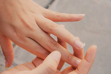 Uñas amarillentas: ¿por qué aparecen y cómo solucionarlo? Uñas amarillentas: ¿por qué aparecen y cómo solucionarlo?
