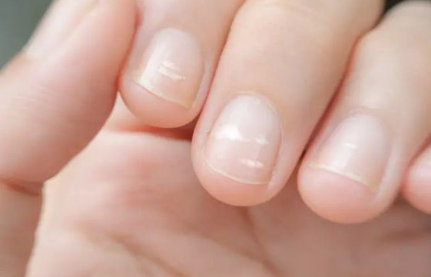 marcas blancas en las uñas