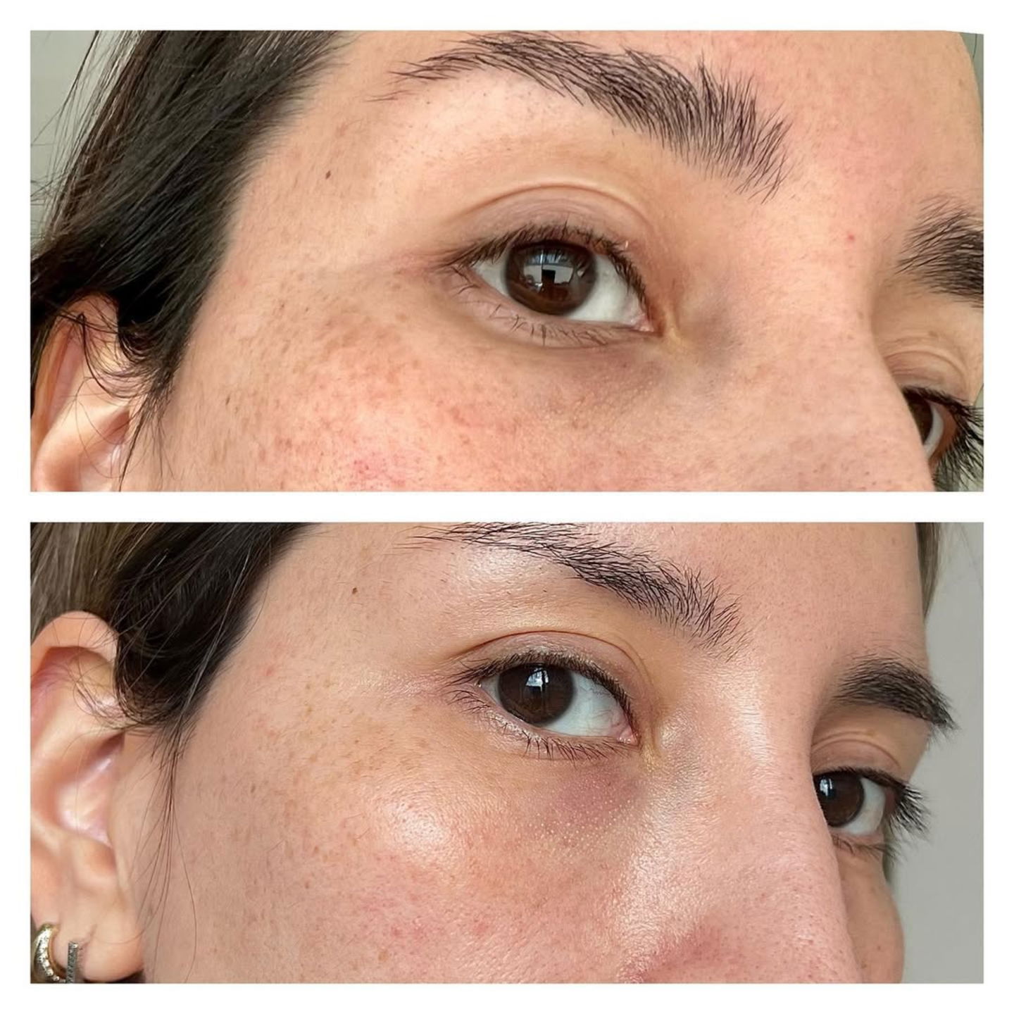 Antes y después Anti-Pigment @javierafierro.makeup