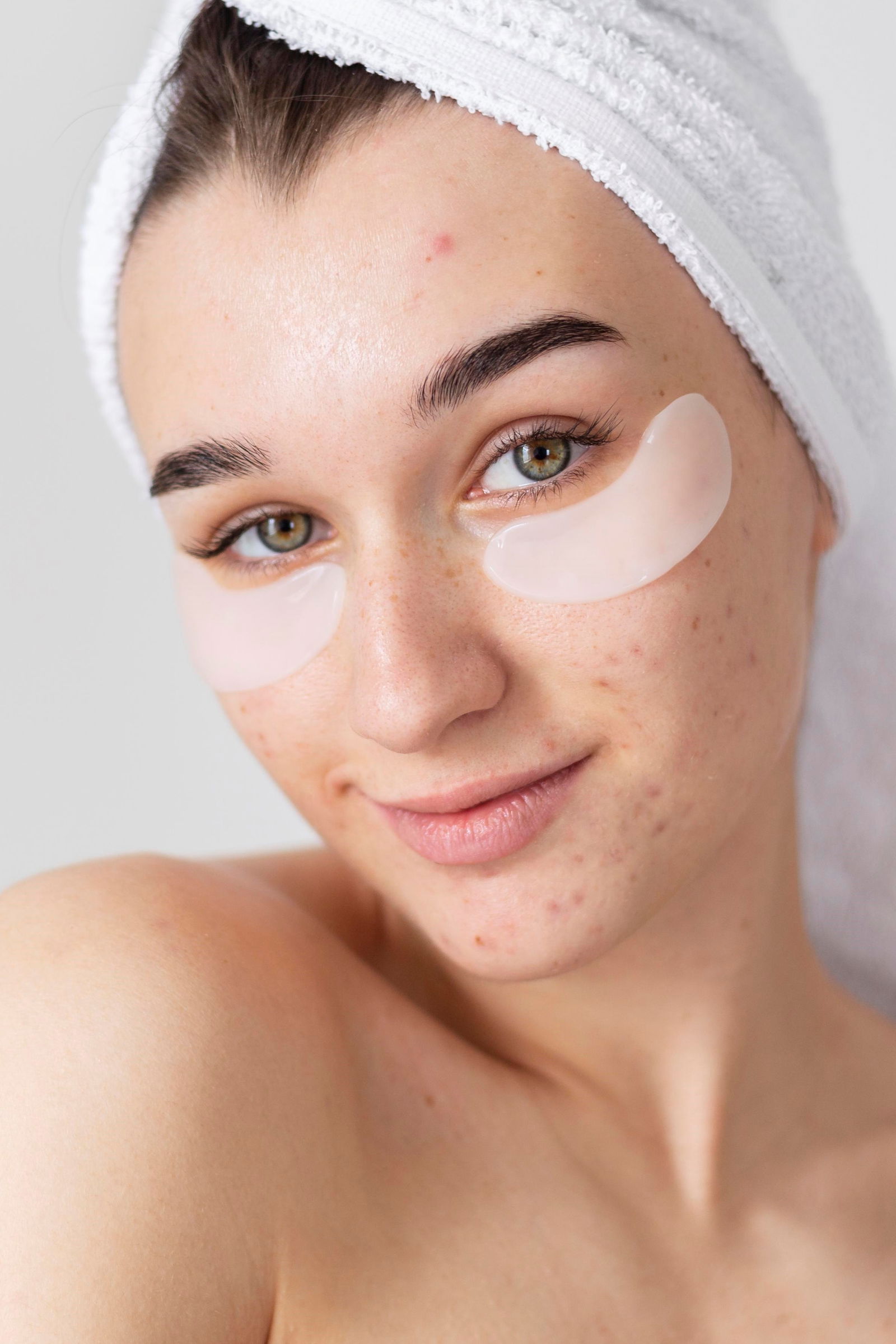 Cuidado facial piel con acné